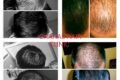 Chahal hair Clinic - Feature Photo