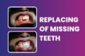 Noble Care Dental Clinic | Dental Clinic In Karelibaug | Dentist In Karelibaug - Feature Photo