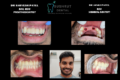 Sushrut dental clinic - Feature Photo