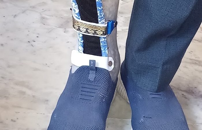 Baroda Rehab Centre- Prosthetic & Orthotic Devices - Feature Photo