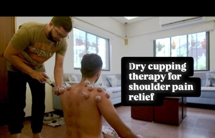 Cups &cure hijama VADODARA - Feature Photo