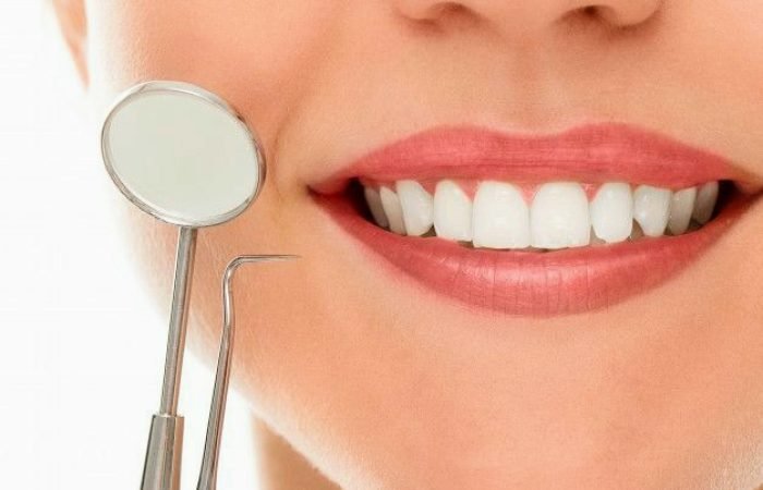 Dental Clinic - Bright Smile Dental Care | Dental Aligners, Implant Center Vadodara - Feature Photo
