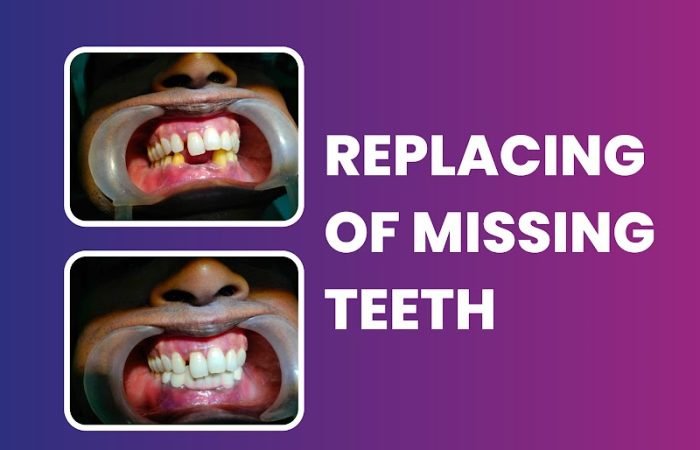 Noble Care Dental Clinic | Dental Clinic In Karelibaug | Dentist In Karelibaug - Feature Photo