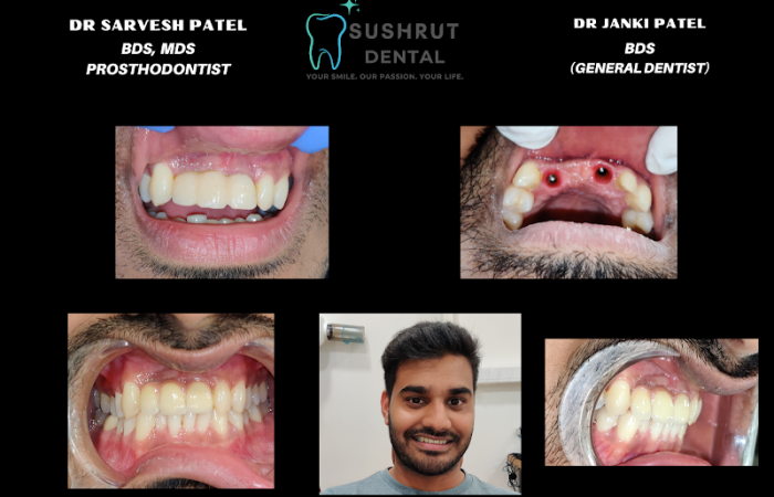 Sushrut dental clinic - Feature Photo